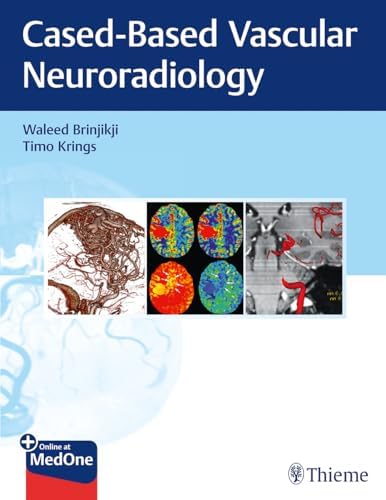 Decision Making in Neurovascular Disease: 9781684200573: Medicine